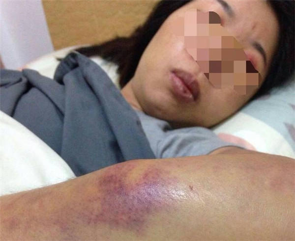 妇女澈尿的简单介绍