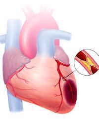 心脏是如何供血的?心脏供血的顺序流程